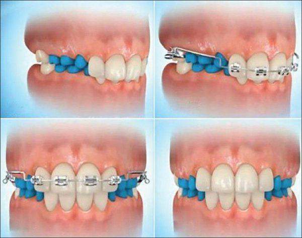 orthodontie lausanne