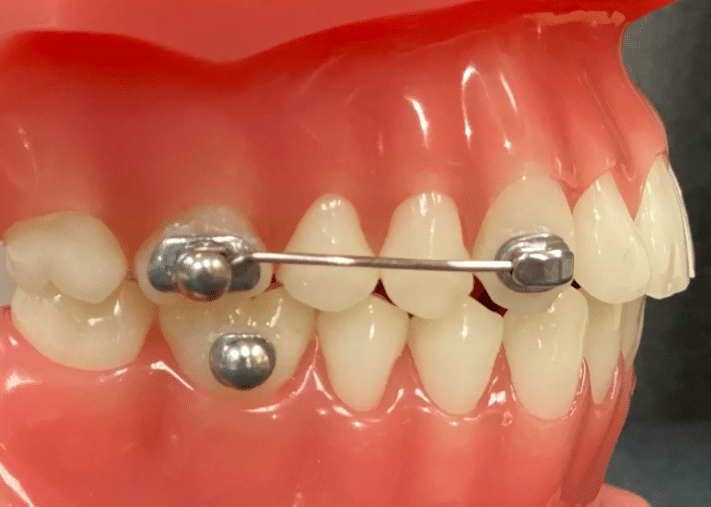Orthodontiste lausanne